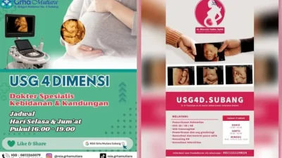 Cari USG 4D di Subang? Ini Daftar Tempat, Biaya, dan Waktu Terbaik Pemeriksaan Kehamilan