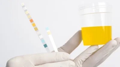 DPRD dan Pemkab Subang Dukung Tes Urine Pelajar untuk Cegah Penyalahgunaan dan Pemberantasan Obat-obatan Terlarang