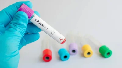 Kasus Influenza di Indonesia Meningkat, Kemenkes Beberkan Cara Cegah Anak Tertular