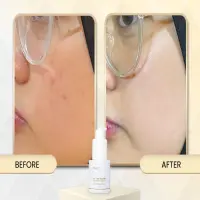 B Erl Active Glow Booster Serum: Rahasia Kulit Cerah, Lembap, dan Glowing Alami