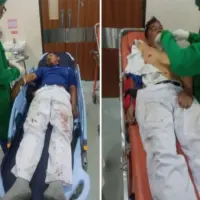 Alami Kecelakaan di Tol Cipularang, Saudara Kandung Dedi Mulyadi Dilarikan ke RS Hamori