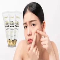 Jerawat Muncul? Oles Ini, Jangan Dipencet: B ERL Very Berry Acne Spot Treatment, Senjata Praktis Lawan Jerawat Membandel