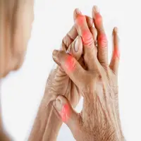 Tanaman Herbal Untuk Asam Urat yang Banyak Digunakan Oleh Nenek Moyang