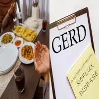 Tips Puasa untuk Penderita GERD: Bye-bye Heartburn dan Perut Kembung!