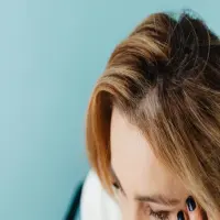 5 Cara Menghilangkan Ketombe yang Bisa Kamu Coba di Rumah