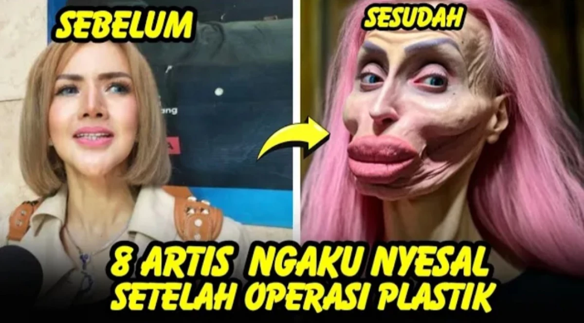 Gagal Cantik! Selebriti Indonesia yang Menyesal Setelah Operasi Plastik